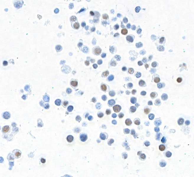 <b>Detection of mouse MafA in FFPE beta-TC-6 cells by immunocytochemistry.</b> <i>Antibody:</i> Rabbit anti-MafA recombinant monoclonal antibody [BLR067G] (A700-067 lot 3). <i>Secondary:</i> HRP-conjugated goat anti-rabbit IgG (A120-501P). <i>Substrate:</i> DAB.