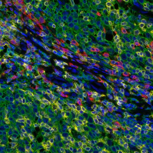 <b>Detection of human CD3E (yellow), CD8 alpha (red), and CD20 (green) in FFPE tonsil by IHC-IF.</b> Rabbit anti-CD3E recombinant monoclonal [BL-298-5D12] (A700-016), rabbit anti-CD8 alpha recombinant monoclonal [BLR044F] (A700-044), mouse anti-CD20 monoclonal [L26] (A500-017A). Secondary: HRP-conjugated goat anti-rabbit IgG (A120-501P) and HRP-conjugated goat anti-mouse IgG (A90-116P). Substrate: Opal™ 520, 620, and 690. Counterstain: DAPI (blue).