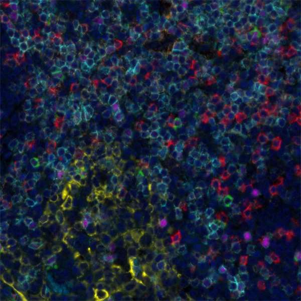 <b>Detection of human CD3 (cyan), CD4 (orange), CD8 (red), cytokeratin (yellow), FOXP3 (magenta), and LAG3 (green) in FFPE tonsil by IHC-IF.</b> Rabbit anti-CD3E recombinant monoclonal [BL-298-5D12] (A700-016), Rabbit anti-CD4 recombinant monoclonal [BL-155-1C11] (A700-015), rabbit anti-CD8 alpha recombinant monoclonal [BLR044F] (A700-044), mouse anti-cytokeratin monoclonal [AE1/AE3] (A500-019A), rabbit anti-FOXP3 recombinant monoclonal [BLR034F] (A700-034) and rabbit anti-LAG3 recombinant monoclonal [BLR027F] (A700-027). Secondary: HRP-conjugated goat anti-rabbit IgG (A120-501P) and HRP-conjugated goat anti-mouse IgG (A90-116P). Substrate: Opal™ 480, 520, 570, 620, 690 and 780. Counterstain: DAPI (blue).